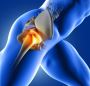 The Best Hip Pain Treatments Durham, ON