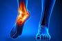 End Foot Pain with Our Revolutionary Treatment Ajax, Durham!