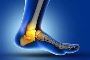 What should I expect after my ankle ligament surgery?