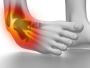 Ankle pain treatment in Bhubaneswar