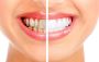 Fraser Dental Fraser Dental