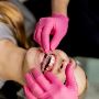 Invisalign in Raleigh, NC: Transform Your Smile