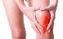 Knee Pain Treatment Specialists In NYC