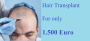 Hair Transplant in Turkey