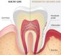 Top Information About Deep Cleaning from Emergency Dentist
