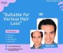 Hair Patches Suitable for Various Types of Hair Loss
