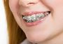 Orthodontist Near Me Orthodontist Near Me
