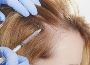 Unlocking Hair's Potential: The Power of Hair PRP Treatment