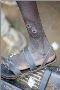 GS SCORE- Guinea worm disease inched closer to eradication