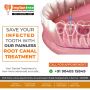 Best Root Canal Treatment in Chennai