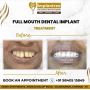 Best Dental Implant Centre in Chennai 