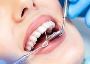 !Avoid mouthwash TOP dentists warn