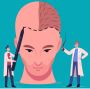 Discover Best Hair Loss Treatment for Men w/ IHLS Australia