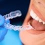 Affordable Clear Teeth Aligners Cost in Kolkata 