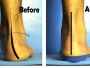 Best Ankle pain treatment in Parramatta