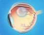 Retinal detachment surgery in meerut| Jawahar eye Hospital