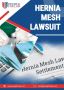 Hernia Mesh Lawsuit in Florida - People For Law Hernia Mesh Lawsuit in Florida - People For Law