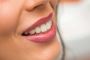 Why Should We Visit Cosmetic Dentistry?