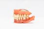 Dentures - Replace Missing Teeth and Restoring Your Smile