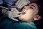 Reasons of Removal of Teeth