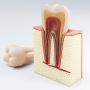 Dental Services Root Canal Therapy