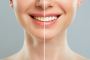 Get a Brighter Smile Today with Teeth Whitening