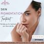 Best skin pigmentation treatment | Look n shape clinic