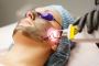 7 things to know before having laser treatment for acne scar