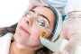 5 Interesting facts of laser treatment for acne scars