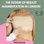 The Fusion of Breast Augmentation in London