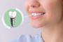 Best dental implants treatment in Faridabad
