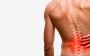 Back Pains Specialists West Orange, New Jersey