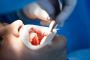 Orthodontics Damon System - Masri Orthodontics