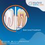 Root Canal Treatment in Mayfield, Newcastle |Mayfield Dental