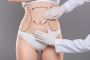 Is Liposuction Worth It?