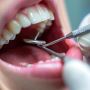Get Perfect Teeth with Our Orthodontic Treatments!