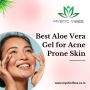 Top Aloe Vera Gels for Acne Prone Skin