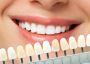Cosmetic Dentistry Service in Castro Valley | My Valley View