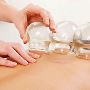 The Best Cupping Treatment California