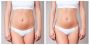 Best Body contouring services in Cypress, TX