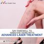 laser treatment for varicose veins procedure - Anesthesia