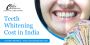 Teeth Whitening Cost in Delhi