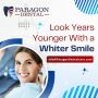 Brighten Your Smile with Professional Teeth Whitening