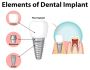 Dental Implant | Tooth Implant Dentist Livonia
