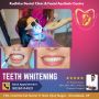 The Power of a Smile: Boost Your Confidence with Teeth White