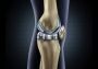 Are you Looking for Best Knee Pain Clinic in Pooler - Procar
