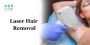 Laser Hair Removal In Bangalore