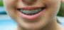 Dental, only $19.95/month