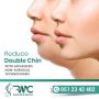 Double Chin Removal in Islamabad -Double Chin Reductions-RMC