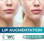 Lip Filler Treatment in Islamabad, Injections -RMC